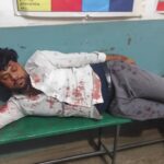 भीषण सड़क हादसा: जालौन के कोंच में दो बाइकों की आमने-सामने जोरदार भिड़ंत, तीन गंभीर रूप से घायल जालौन के कोंच में उरई रोड पर हुल्की माता मंदिर के पास दो मोटरसाइकिलों की भीषण भिड़ंत के बाद सड़क पर बिखरा मलबा और घायलों की मदद करते स्थानीय लोग।