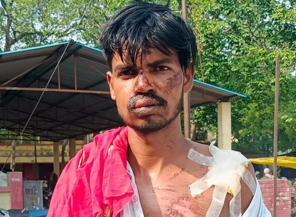 जालौन: तेज रफ्तार बस ने बाइक सवार को रौंदा, गंभीर रूप से घायल युवक ने स्वस्थ होने के बाद दर्ज कराई शिकायत news image जालौन के कोंच में सड़क हादसे के बाद घायल युवक और क्षतिग्रस्त मोटरसाइकिल की सांकेतिक तस्वीर, कोतवाली में शिकायत दर्ज कराते ग्रामीण