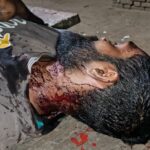 जालौन के कोंच में पारिवारिक विवाद के बाद घायल अवस्था में अस्पताल ले जाया जाता पीड़ित और जांच में जुटी पुलिस की प्रतीकात्मक तस्वीर।