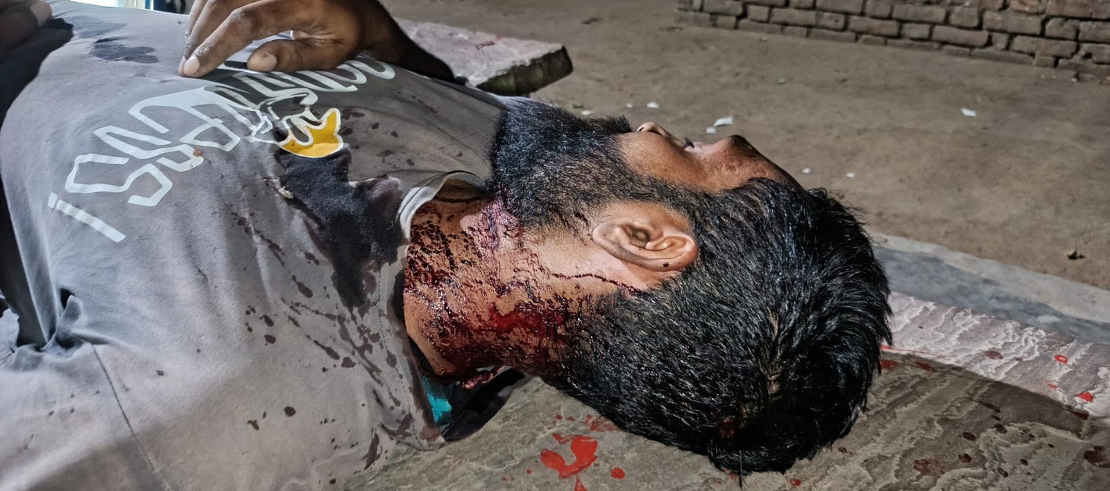 जालौन के कोंच में पारिवारिक विवाद के बाद घायल अवस्था में अस्पताल ले जाया जाता पीड़ित और जांच में जुटी पुलिस की प्रतीकात्मक तस्वीर।