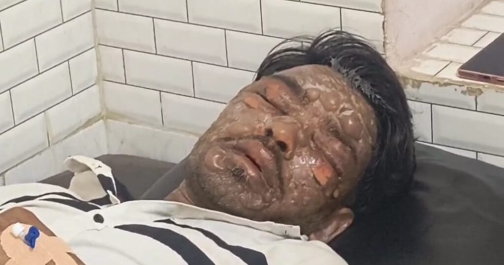 जालौन में बड़ा हादसा: कोंच के कोल्ड स्टोर में गैस रिसाव से मजदूर गंभीर रूप से झुलसा, मानकों को ताक पर रखकर संचालन का आरोप news image उत्तर प्रदेश के जालौन में कोंच-एट रोड पर स्थित कोल्ड स्टोर का बाहरी दृश्य, जहाँ गैस रिसाव के कारण एक मजदूर गंभीर रूप से झुलस गया।