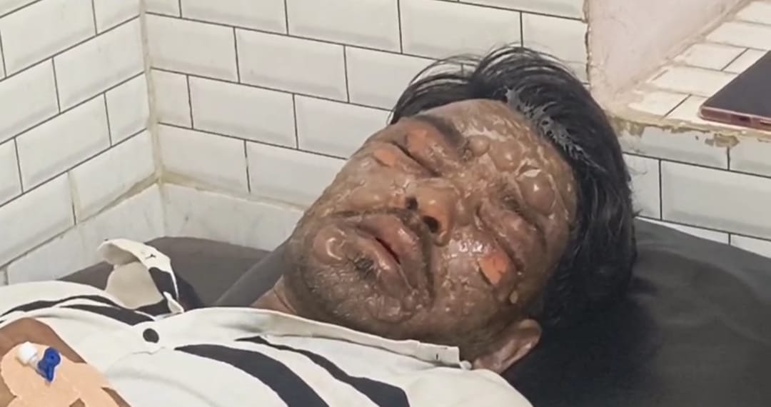 उत्तर प्रदेश के जालौन में कोंच-एट रोड पर स्थित कोल्ड स्टोर का बाहरी दृश्य, जहाँ गैस रिसाव के कारण एक मजदूर गंभीर रूप से झुलस गया।