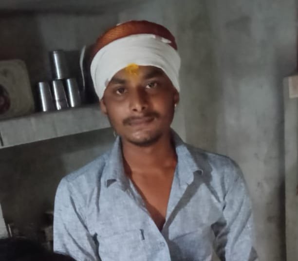 जालौन में तेज रफ्तार का कहर: बाइक की भीषण टक्कर में इंटरमीडिएट छात्र की दर्दनाक मौत, मचा कोहराम news image जालौन में सड़क हादसे के बाद घटनास्थल पर जुटी भीड़ और दुख में डूबे परिजन।