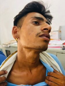 जालौन के कैलिया थाना क्षेत्र में मां-बेटे के साथ हुई मारपीट के बाद पीड़ित परिवार के घर के बाहर एकत्रित ग्रामीण और पुलिस की जांच टीम।