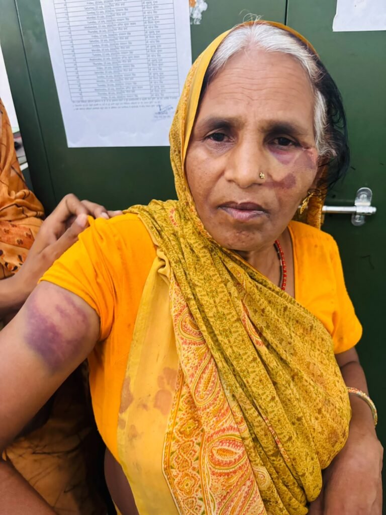 जालौन में दहला सामी गांव: खेत जा रहे मां-बेटे पर दबंगों का कहर, लाठी-डंडों से पीटकर किया लहूलुहान news image जालौन में दहला सामी गांव: खेत जा रहे मां-बेटे पर दबंगों का कहर, लाठी-डंडों से पीटकर किया लहूलुहान news image