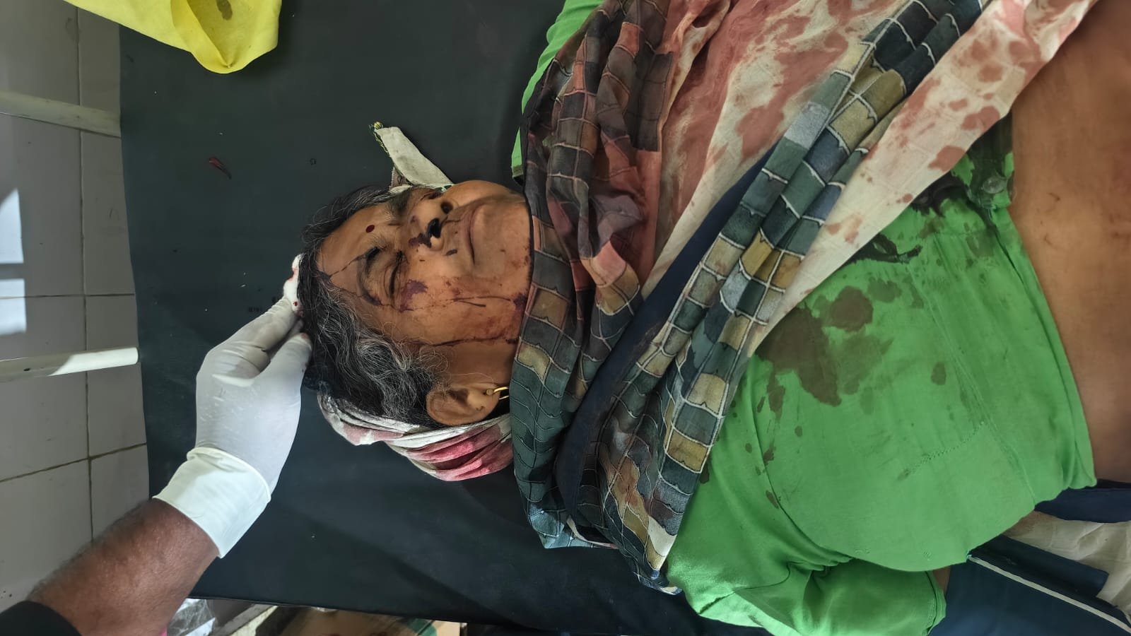 आगरा के फतेहाबाद क्षेत्र के टीकतपुरा खंडेर गांव में खेत के रास्ते को लेकर दो पक्षों के बीच मारपीट की घटना से संबंधित समाचार